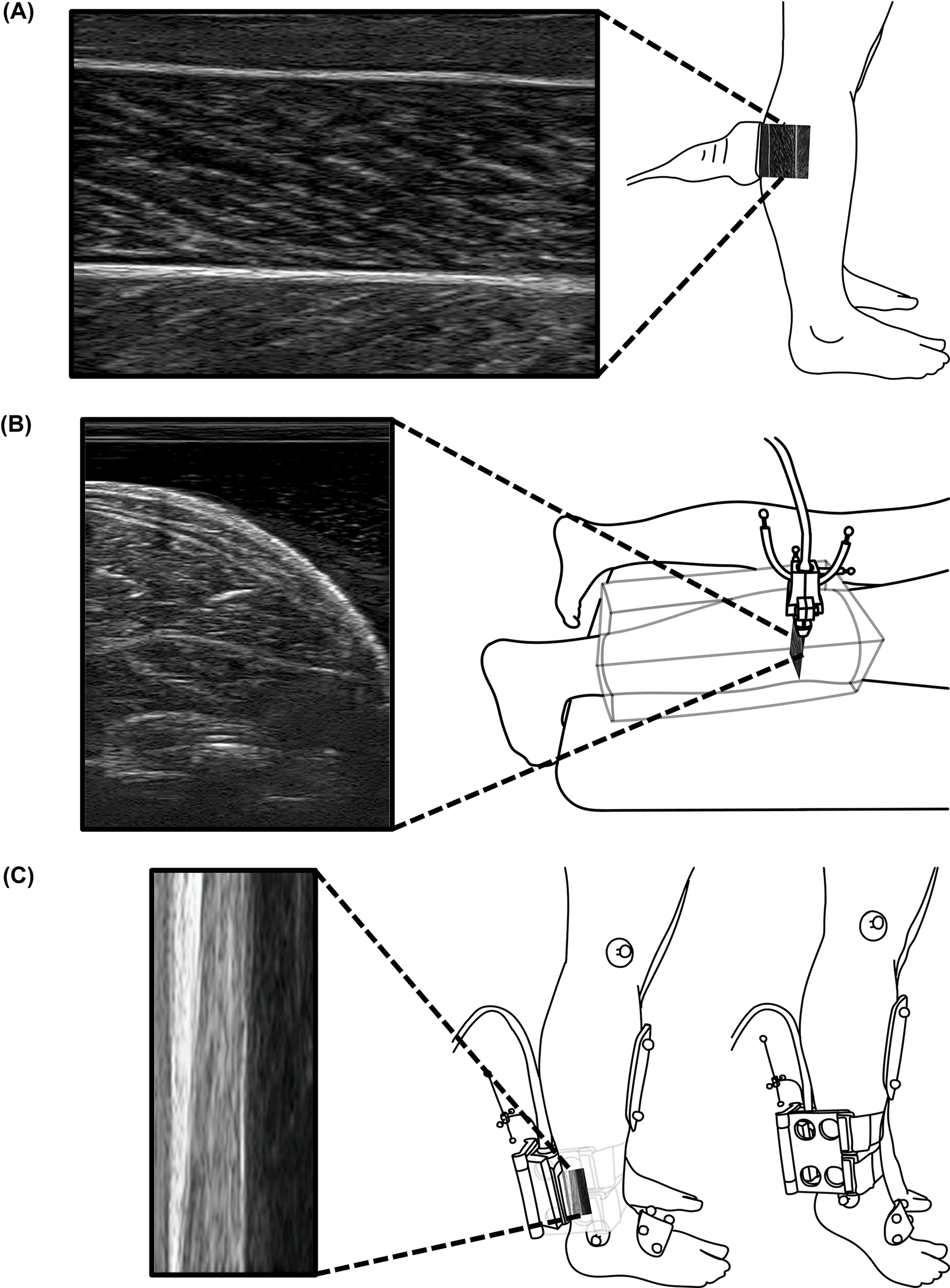 Ultrasound, calf-volume, and Achilles tendon moment arm data collection from the PLOS ONE study.